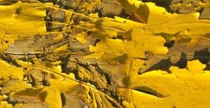 sakit kuning